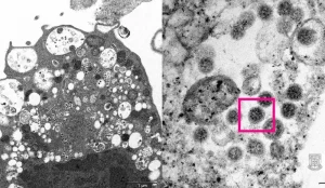 Subvariantes da Ômicron crescem no Brasil; Pernambuco monitora evolução da doença