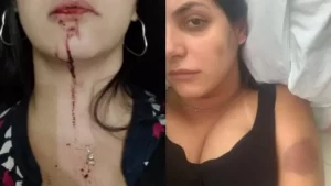 ‘Me estuprava por prazer’, diz mulher que divulgou agressões do ex na internet