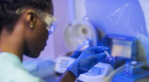 Idoso internado em HOSPITAL PARTICULAR do Recife é terceiro caso de Candida auris em 2023 em Pernambuco