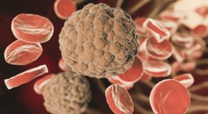 Candida auris: morre mais um paciente com o superfungo em Pernambuco; é o 3º óbito de 2023